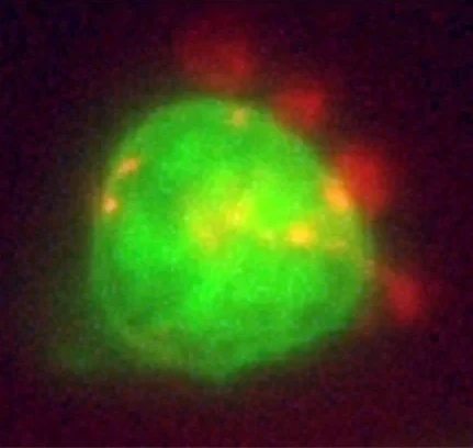 Monocyte